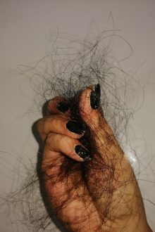 hair loss causes