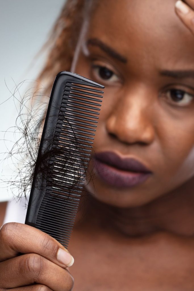 hair loss causes
