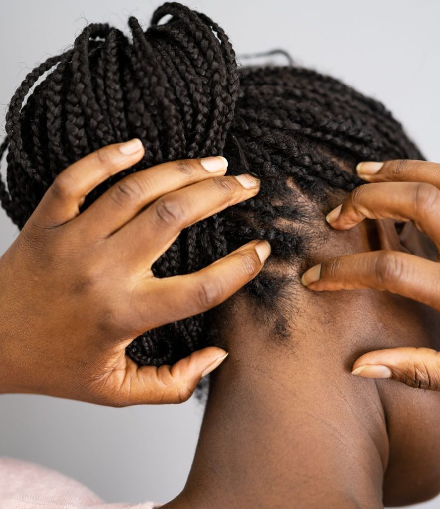 scalp oil