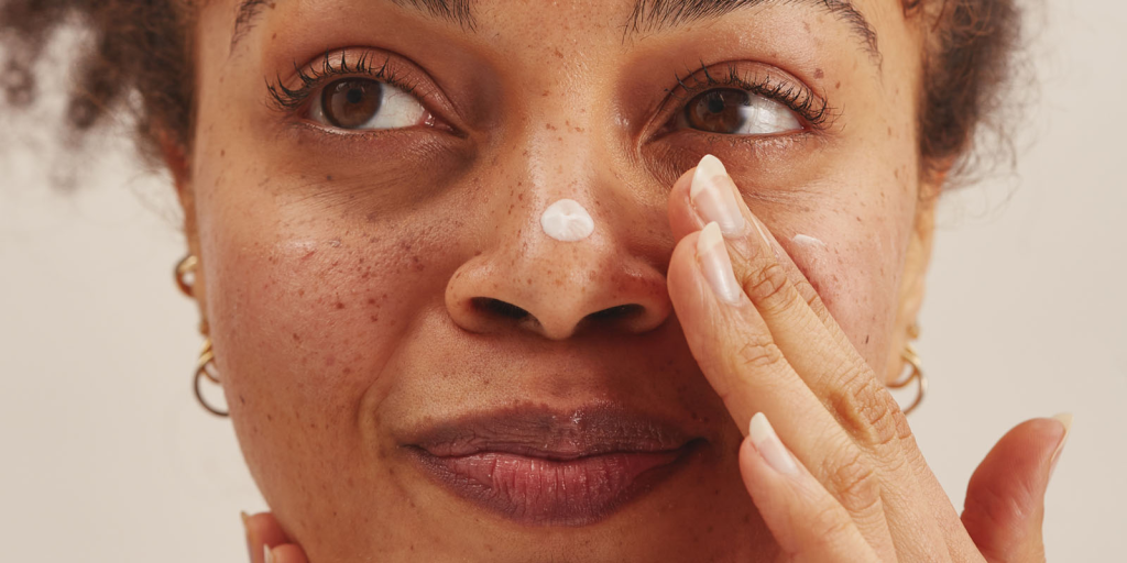The Discovery Of Tretinoin on black skin
